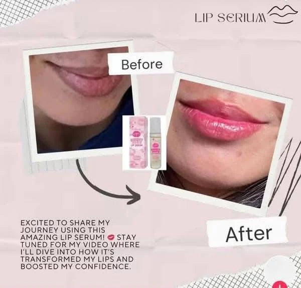 K-Beauty Sweet Kiss Lip Serum with Vitamin E 10ml