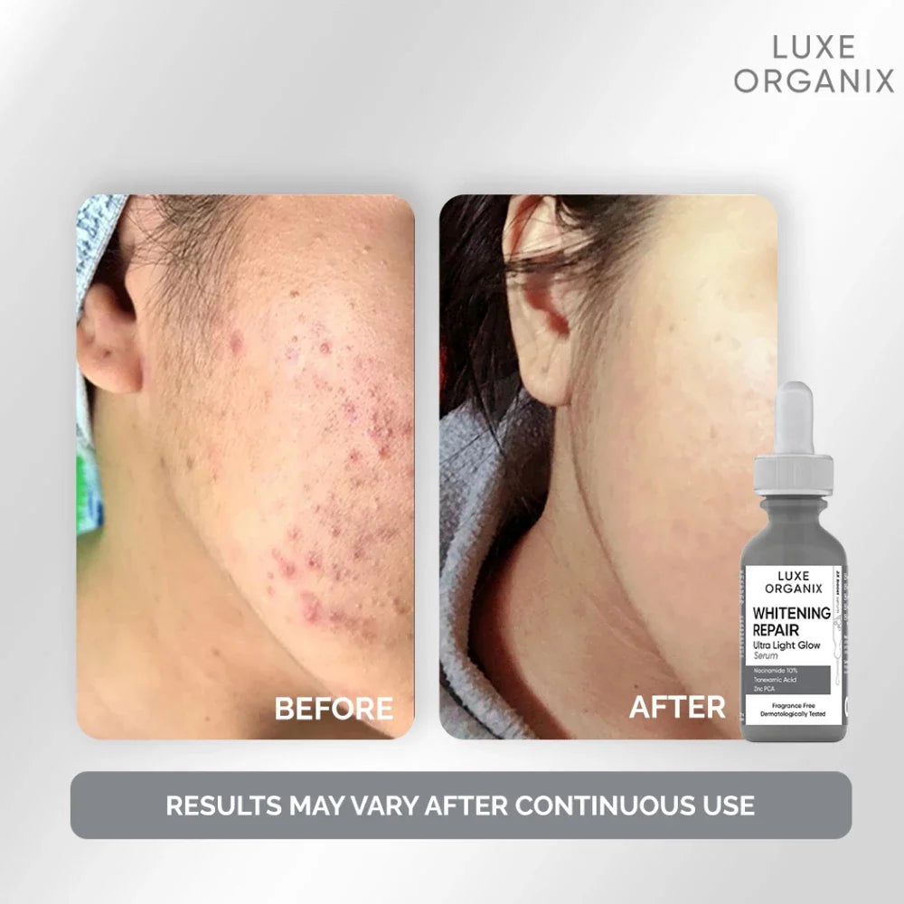 Luxe Organix Whitening Repair Ultra Light Glow Serum