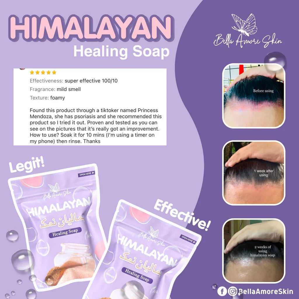 Bella Amore Skin Himalayan Brightening Soap