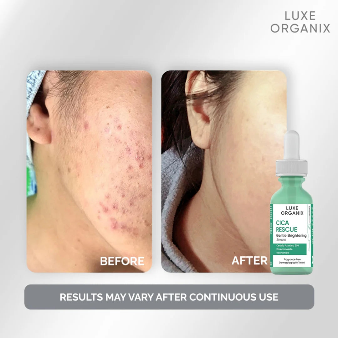 Luxe Organix Cica Rescue Gentle Brightening Bundle