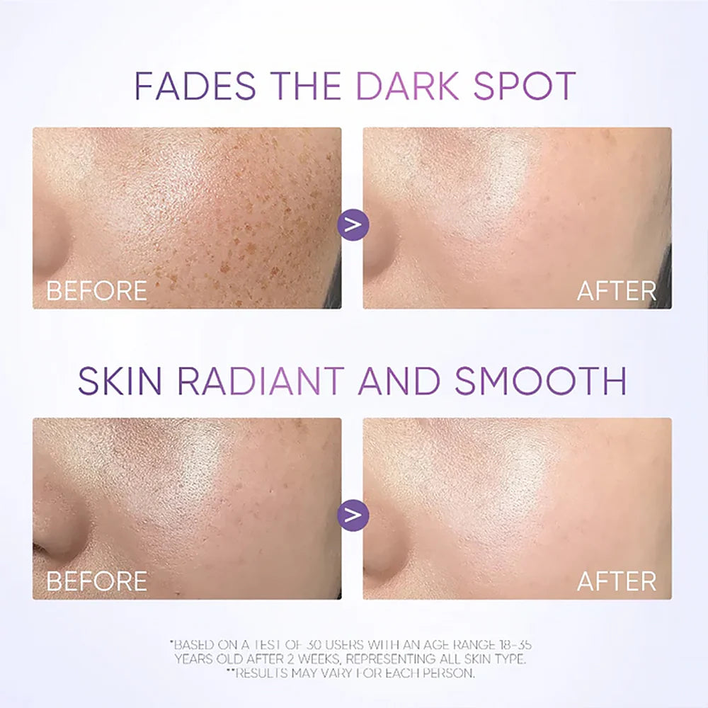 Skintific SymWhite 377 Dark Spot Serum 20ml