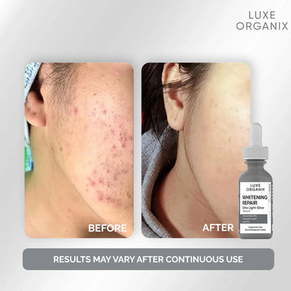 Luxe Organix Whitening Repair Ultra Light Glow Serum