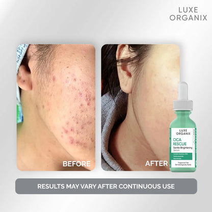 Luxe Organix Cica Rescue Gentle Brightening Serum