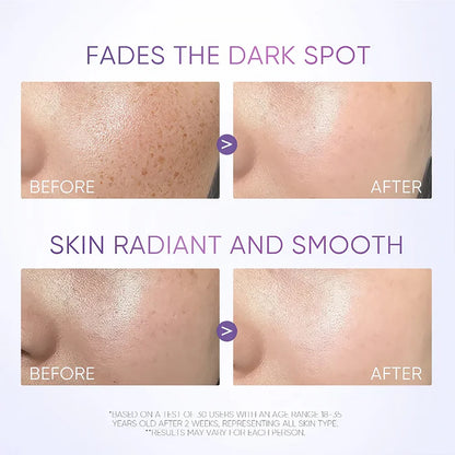 Skintific SymWhite 377 Dark Spot Serum 20ml