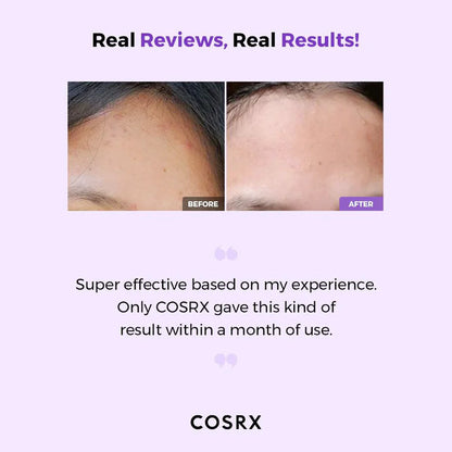 COSRX AHA/BHA Clarifying Treatment Toner 150mL