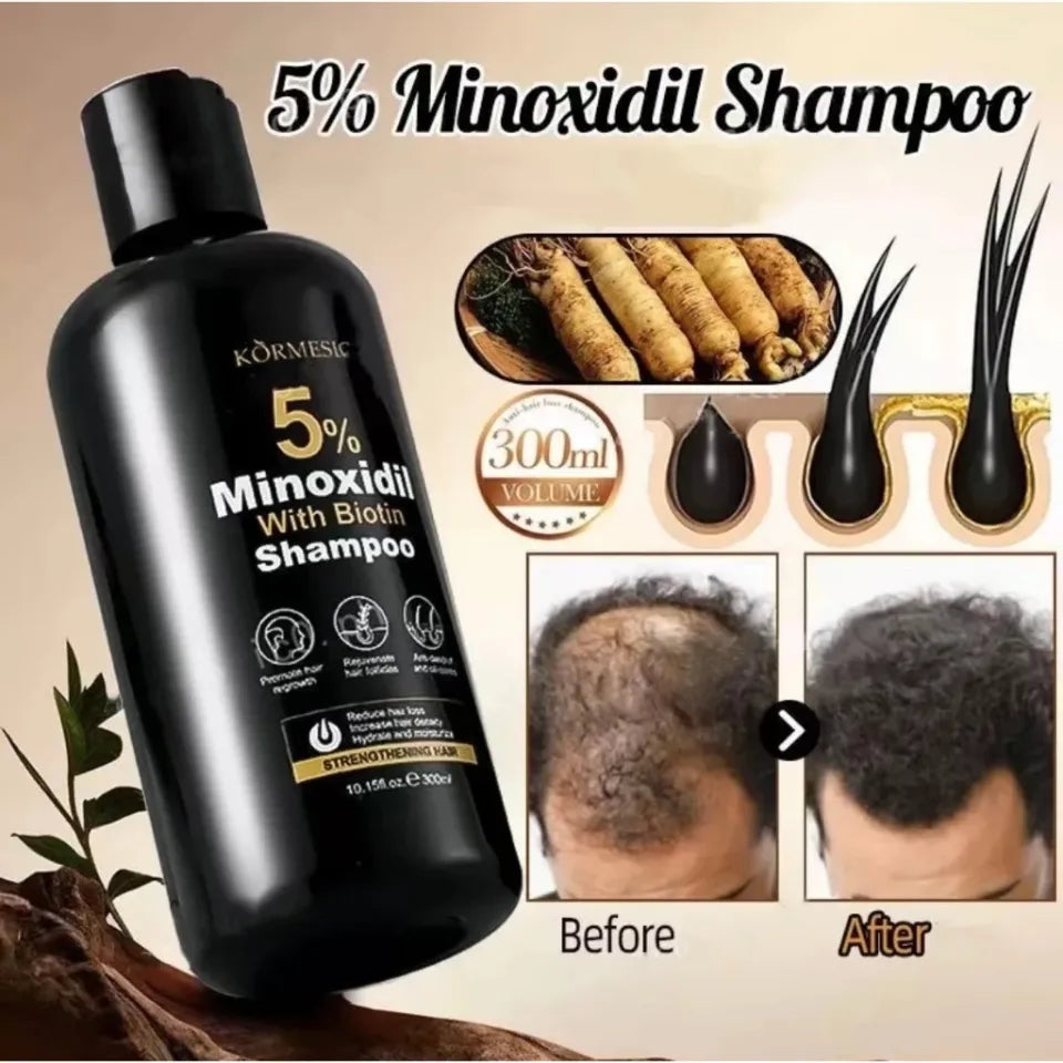 Kormesic 5% Minoxidil with Biotin Shampoo and Conditioner 300ml