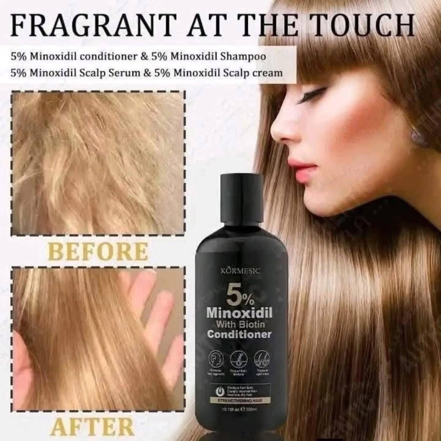 Kormesic 5% Minoxidil with Biotin Conditioner 300ml