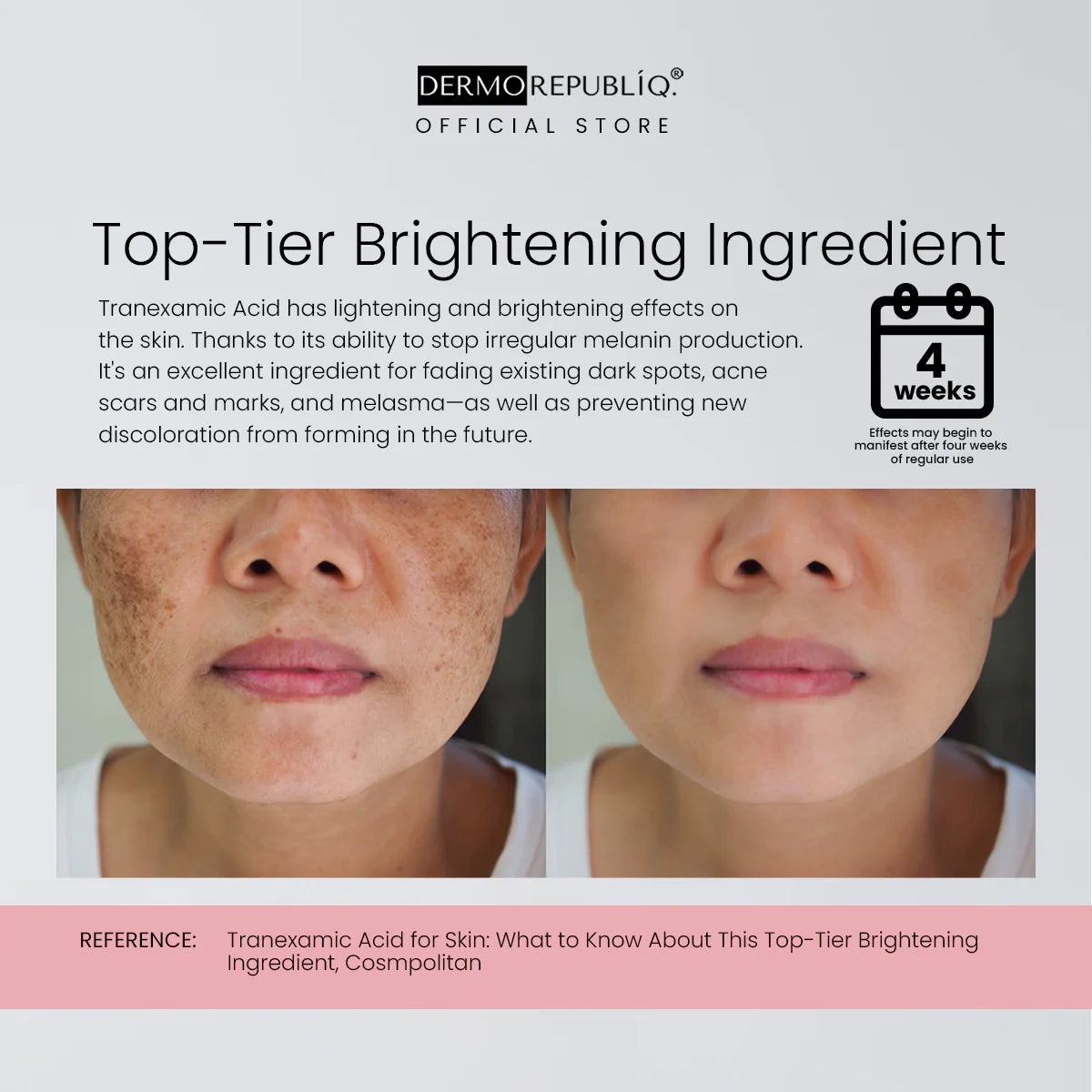 Dermorepubliq 10% niacinamide + 3% tranexamic acid + 2% alpha arbutin ultra white serum